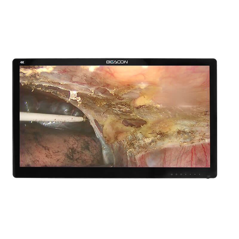 Монитор Beacon S5581P