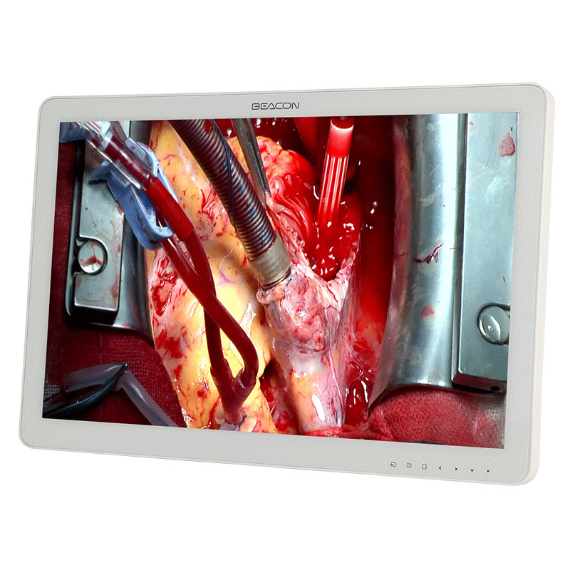 Монитор Beacon S271P